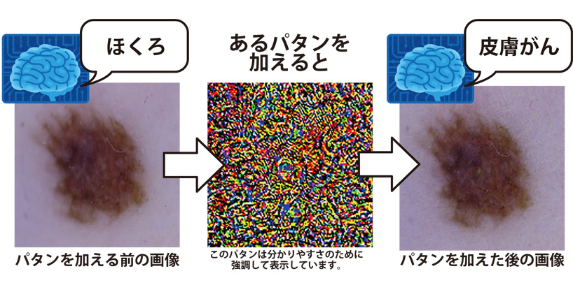 医療AIが「騙される」例